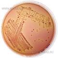 Rhamnose MacConkey (VTEC O26) Agar