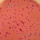 Violet Red Bile Agar (VRBA)